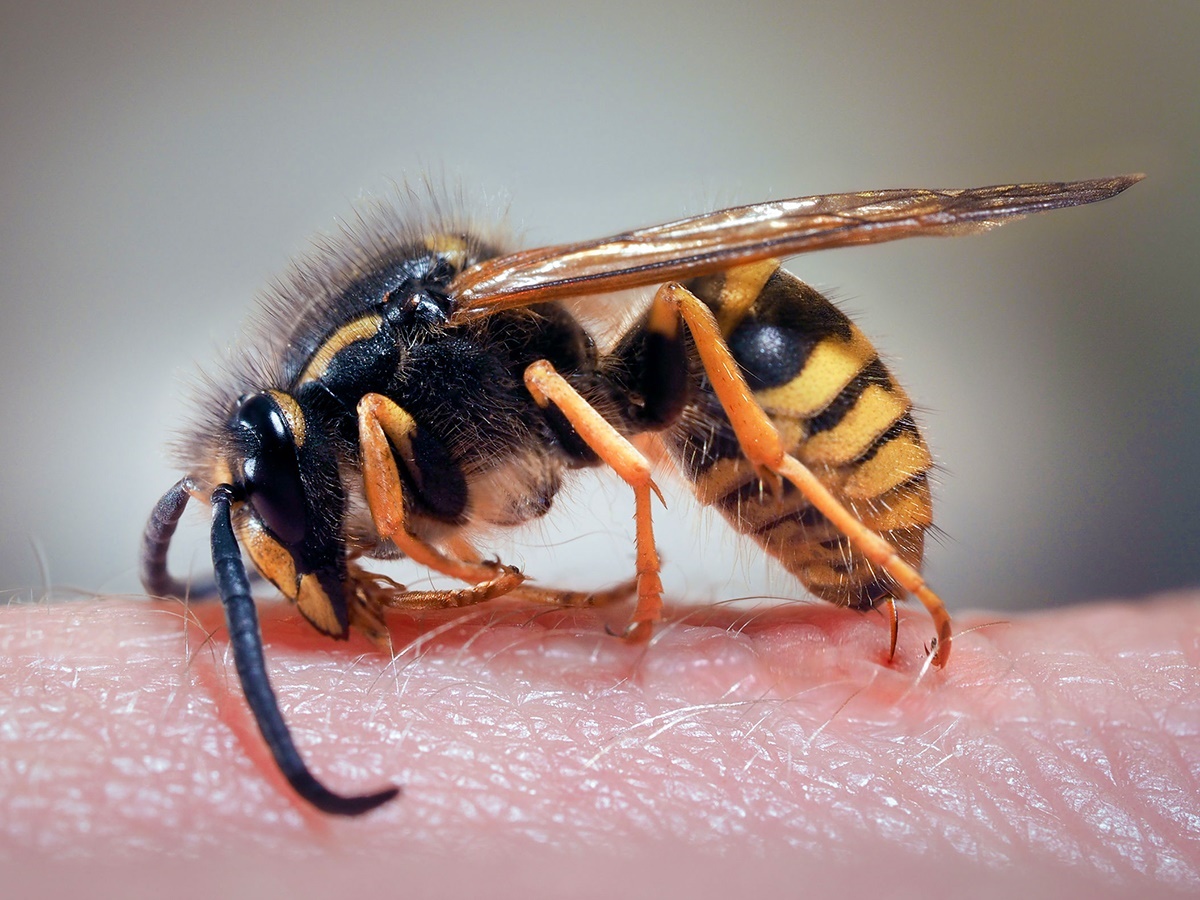 The sting of a wasp on a human hand The sting of a wasp on a human hand
